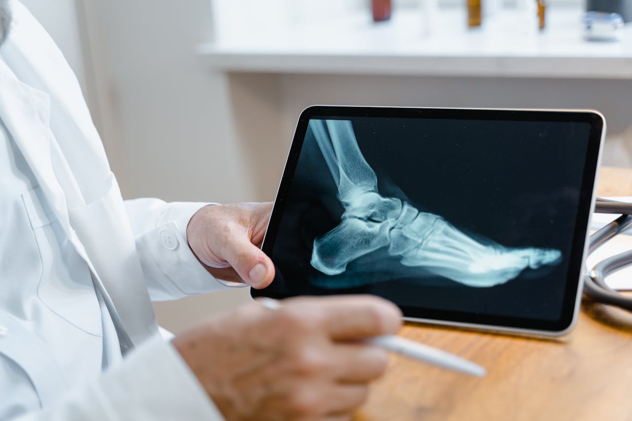 xray on ipad